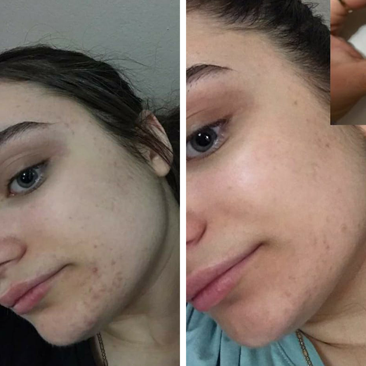 before-and-after-deep-cleanse-20